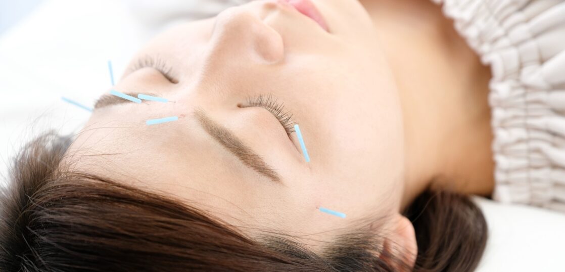 小顔に針治療 調布のリラクゼーション 鍼灸治療はタマンサリ